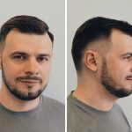 fade-for-receding-hairline