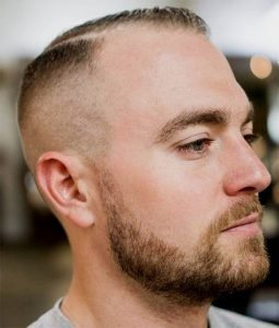 Best-Haircuts-for-Balding-Men
